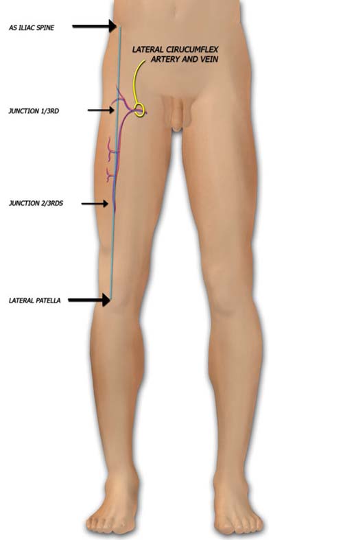 Anatomy of the Thigh Muslces and ALT Flap