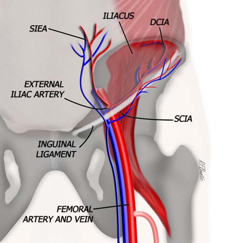 Vascular Anatomy of the DCIA Flap
