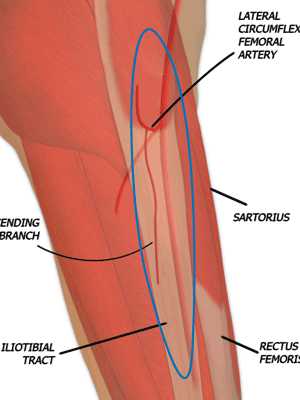 Tensor Fascia Lata (TFL) muscle Flap
